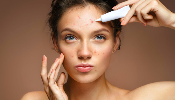 girl with skin acne