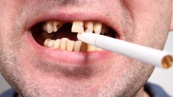 How Does Smoking Affect Your Oral Health?