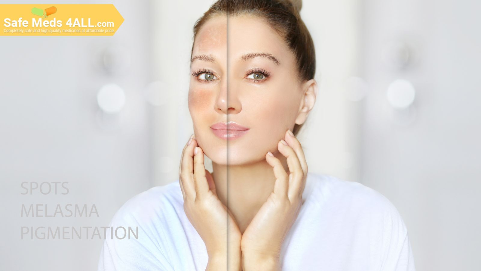 A woman displaying her facial skin, demonstrating the effects of medication before and after it's use.